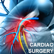 Cardiac Surgery